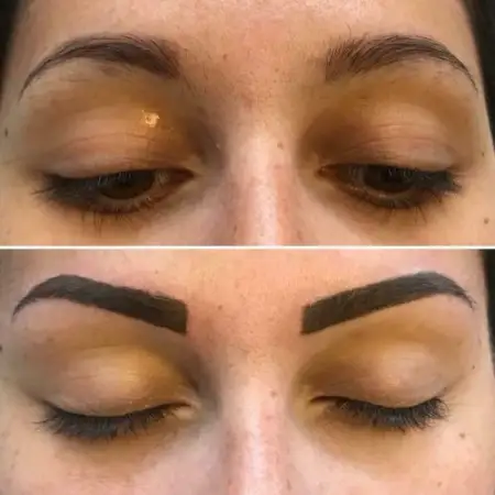 תמונה מהקליניקה של מרילור קוסמטיק